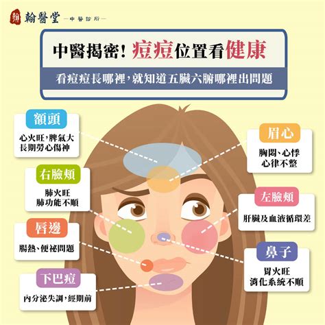 右邊痘痘|青春痘、下巴痘痘長這個位置代表什麼意思？先弄懂長。